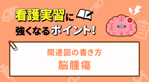 関連図の書き方 脳腫瘍