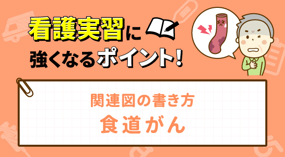 関連図の書き方 食道がん