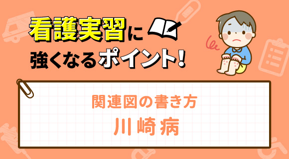 関連図の書き方 川崎病