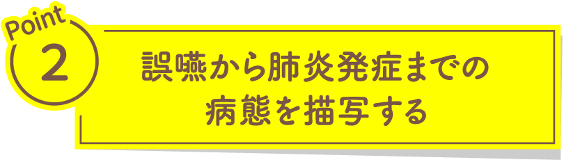 誤嚥から肺炎発症までの病態を描写する