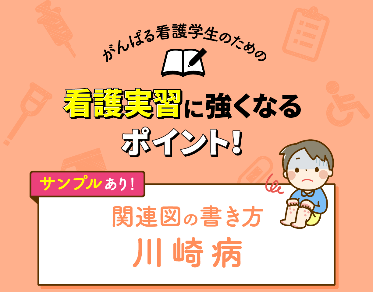 関連図の書き方&サンプル 川崎病