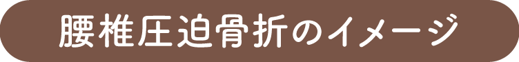 腰椎圧迫骨折のイメージ