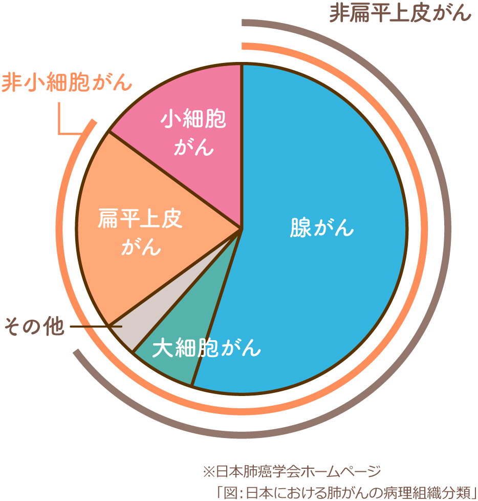 肺がんの病理組織分類