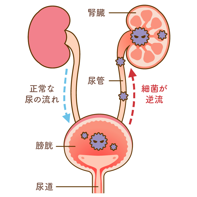 細菌感染のイメージ